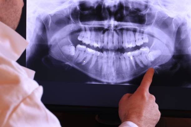 Best Urgent Dental Care for Toothaches in London, OH